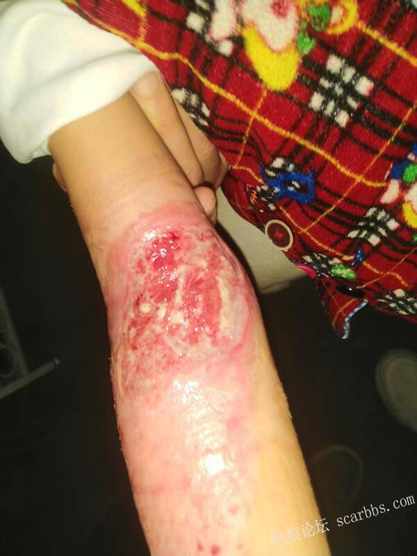 李高令只能流着泪说(信；是孩子的福气…)不信我真的很无奈…(泰安) 