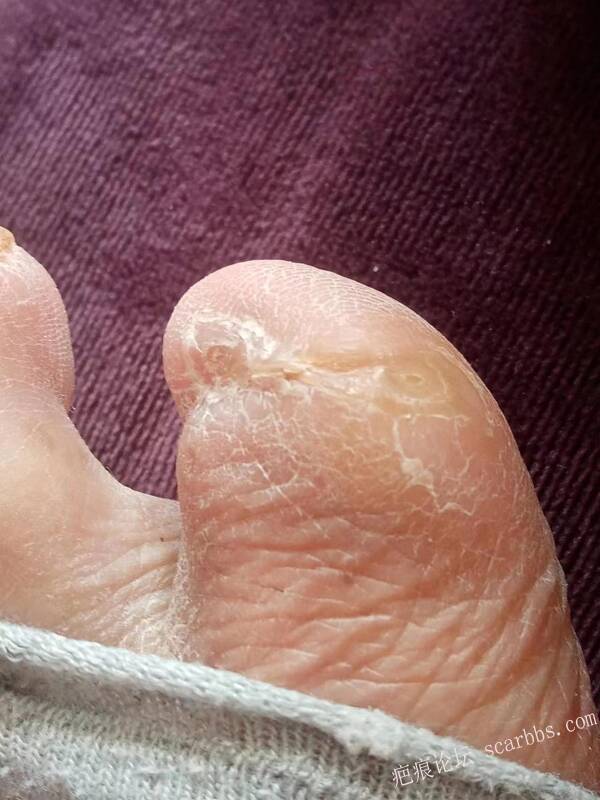 李高令面对（志愿者）有时显的自己很无奈…（青岛） 