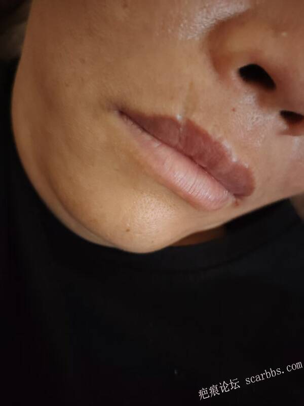 八大处医院做切缝技术好的医生有哪些？好约吗？