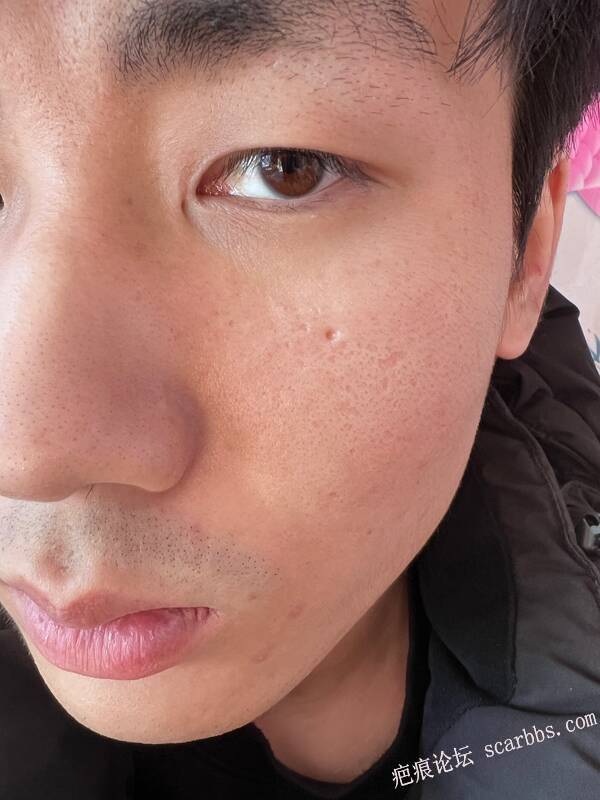 北京切缝的医生哪位比较厉害 