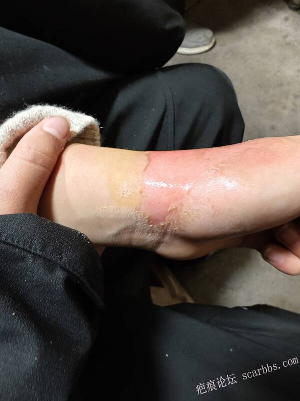 李高令，2026 年除夕夜接治烟台受伤孩子。