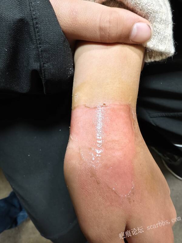 李高令，2026 年除夕夜接治烟台受伤孩子。 