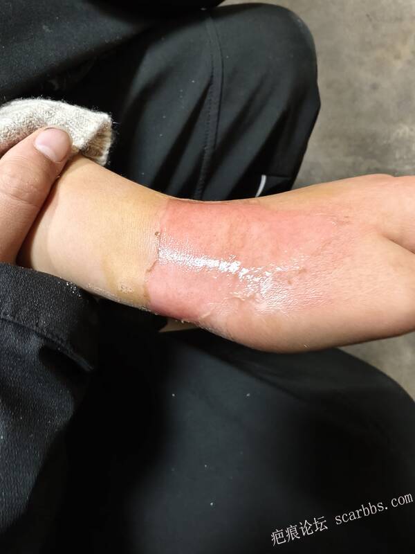 李高令，2026 年除夕夜接治烟台受伤孩子。 