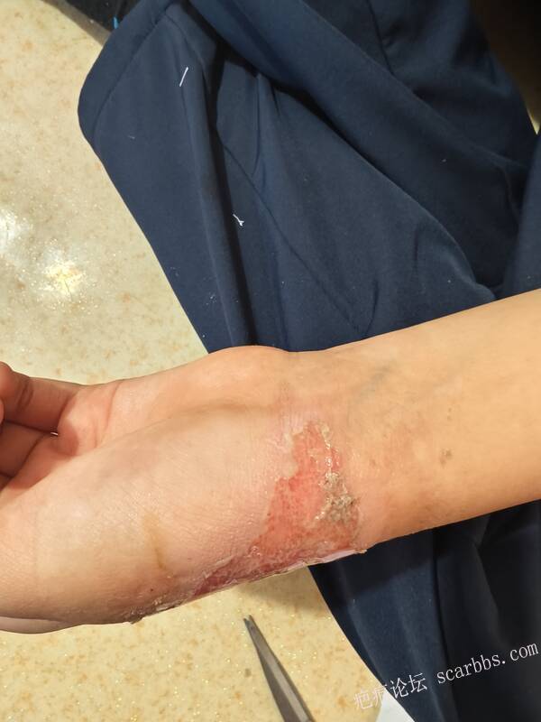 李高令，2026 年除夕夜接治烟台受伤孩子。 