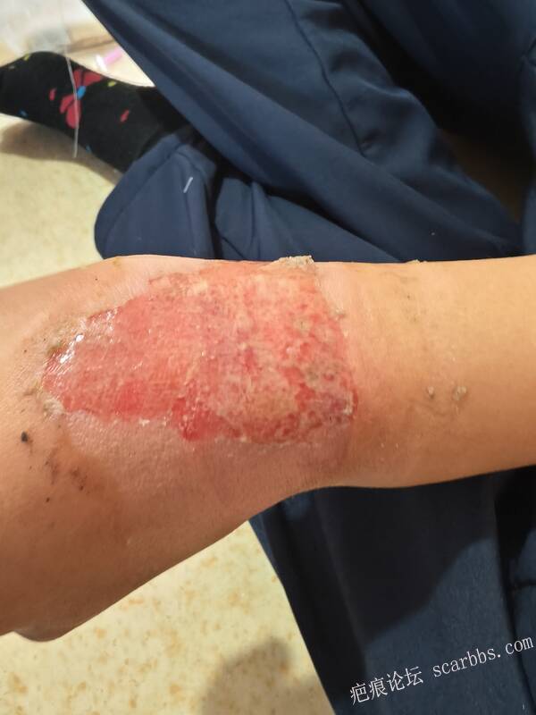 李高令，2026 年除夕夜接治烟台受伤孩子。 