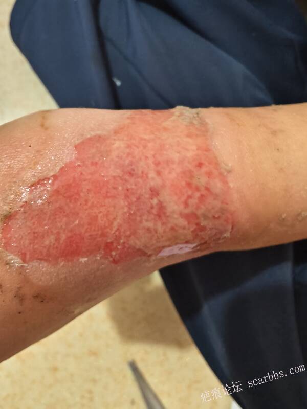 李高令，2026 年除夕夜接治烟台受伤孩子。 