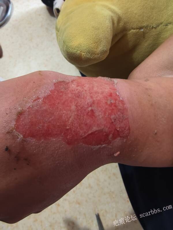 李高令，2026 年除夕夜接治烟台受伤孩子。 