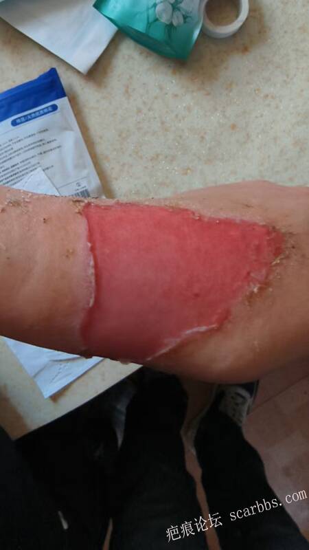 李高令，2026 年除夕夜接治烟台受伤孩子。 