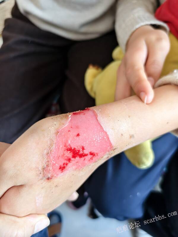 李高令，2026 年除夕夜接治烟台受伤孩子。 