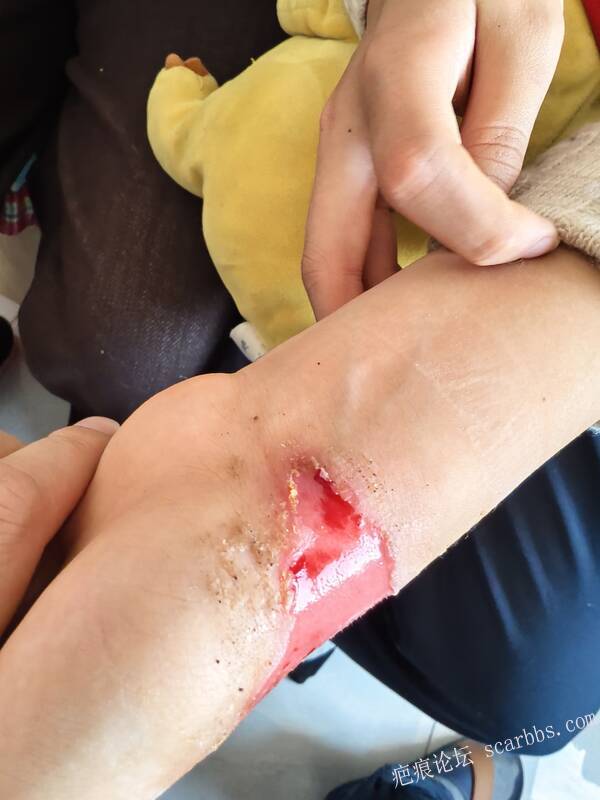 李高令，2026 年除夕夜接治烟台受伤孩子。 