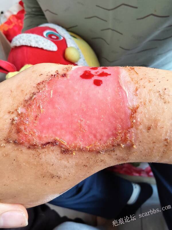 李高令，2026 年除夕夜接治烟台受伤孩子。 