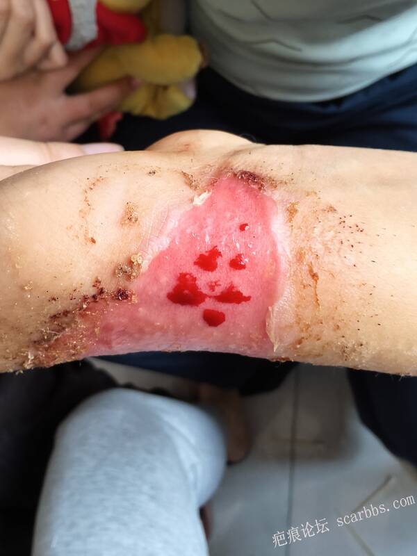 李高令，2026 年除夕夜接治烟台受伤孩子。 