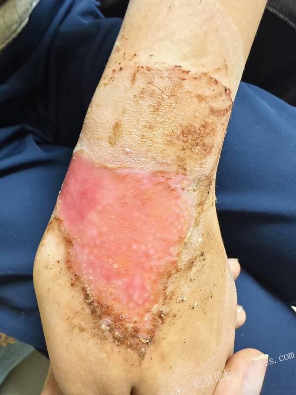 李高令，2026 年除夕夜接治烟台受伤孩子。 