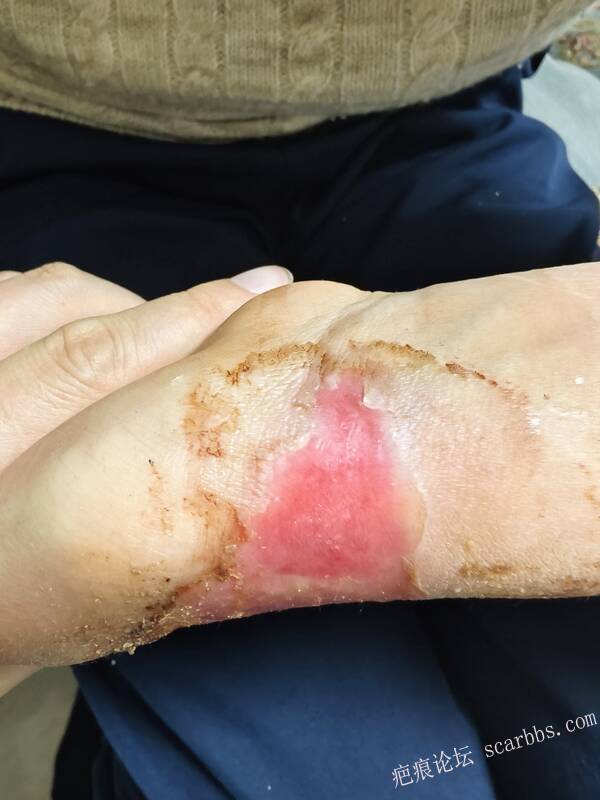 李高令，2026 年除夕夜接治烟台受伤孩子。 