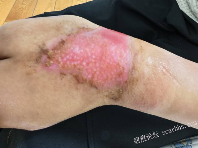 李高令，2026 年除夕夜接治烟台受伤孩子。 