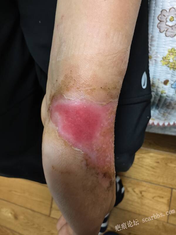 李高令，2026 年除夕夜接治烟台受伤孩子。 