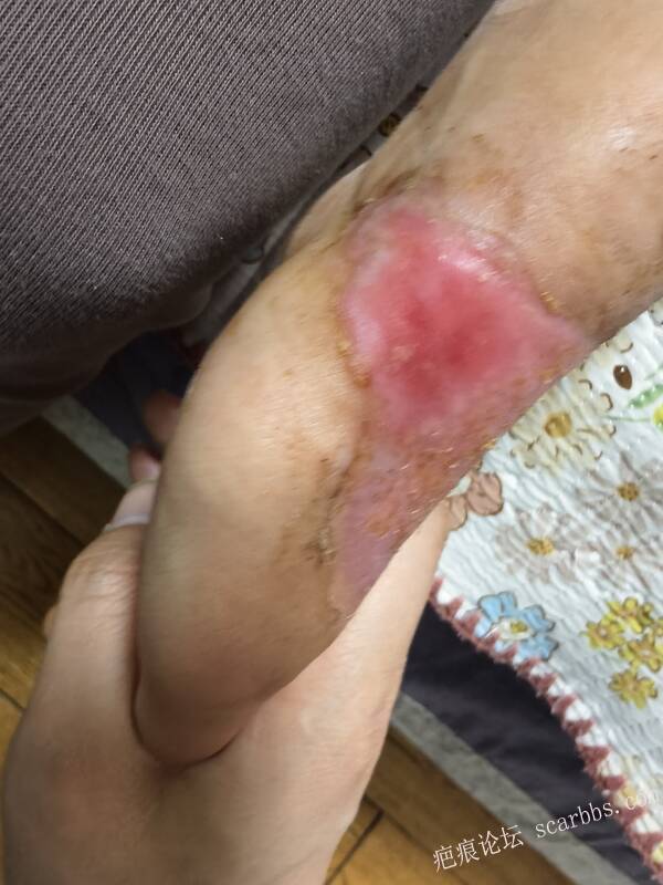 李高令，2026 年除夕夜接治烟台受伤孩子。 