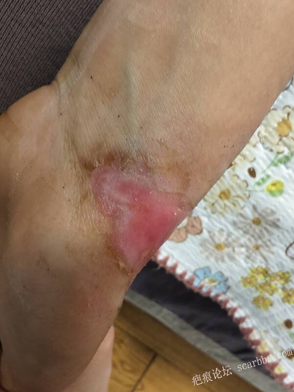 李高令，2026 年除夕夜接治烟台受伤孩子。 