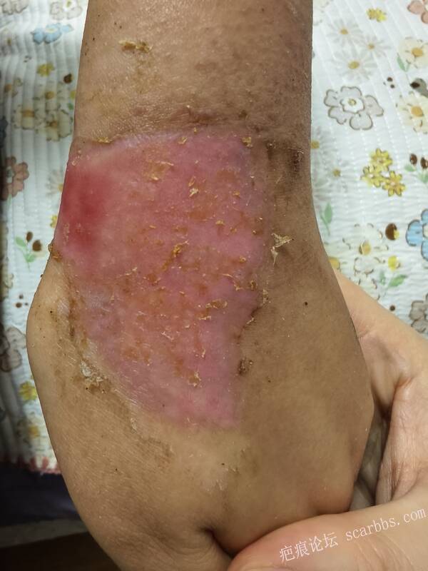 李高令，2026 年除夕夜接治烟台受伤孩子。 