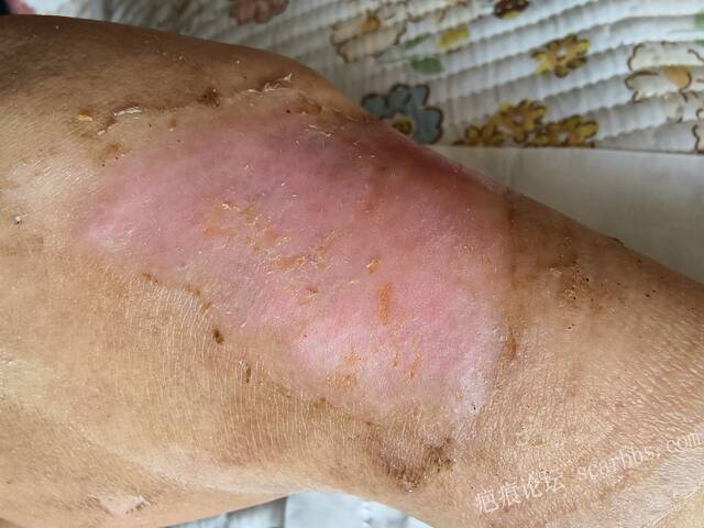 李高令，2026 年除夕夜接治烟台受伤孩子。 