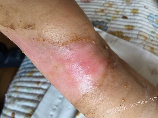 李高令，2026 年除夕夜接治烟台受伤孩子。 