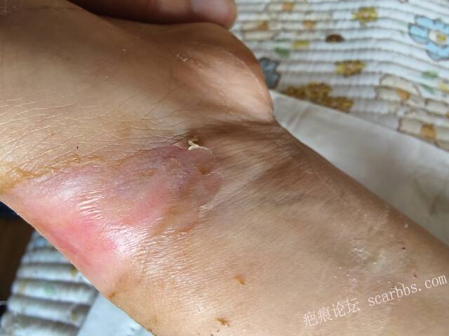 李高令，2026 年除夕夜接治烟台受伤孩子。 