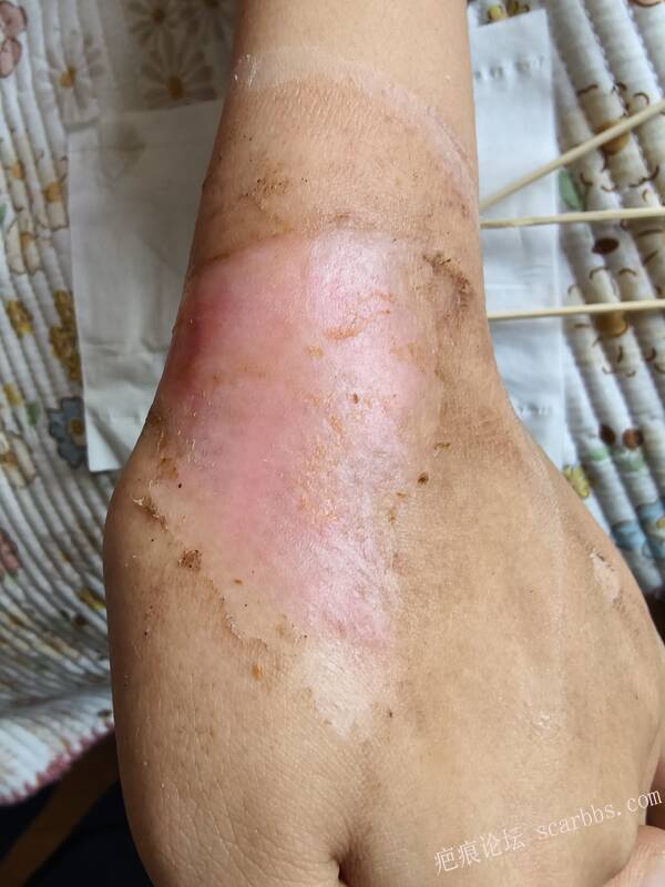 李高令，2026 年除夕夜接治烟台受伤孩子。 