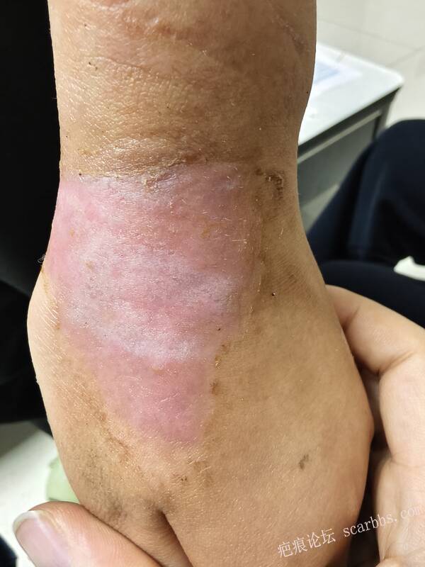 李高令，2026 年除夕夜接治烟台受伤孩子。 