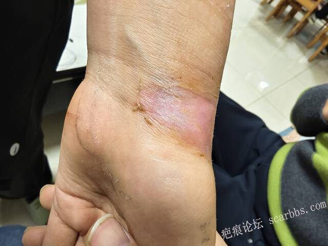 李高令，2026 年除夕夜接治烟台受伤孩子。 