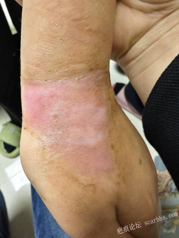 李高令，2026 年除夕夜接治烟台受伤孩子。 