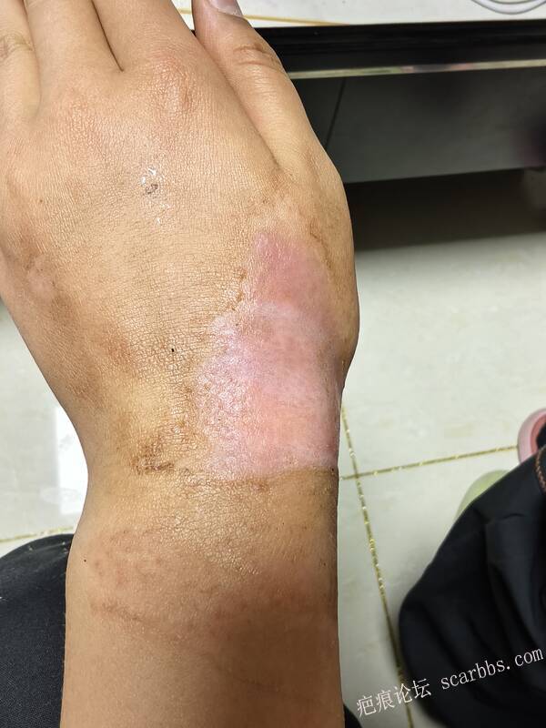 李高令，2026 年除夕夜接治烟台受伤孩子。 