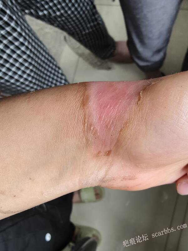 李高令，2026 年除夕夜接治烟台受伤孩子。 