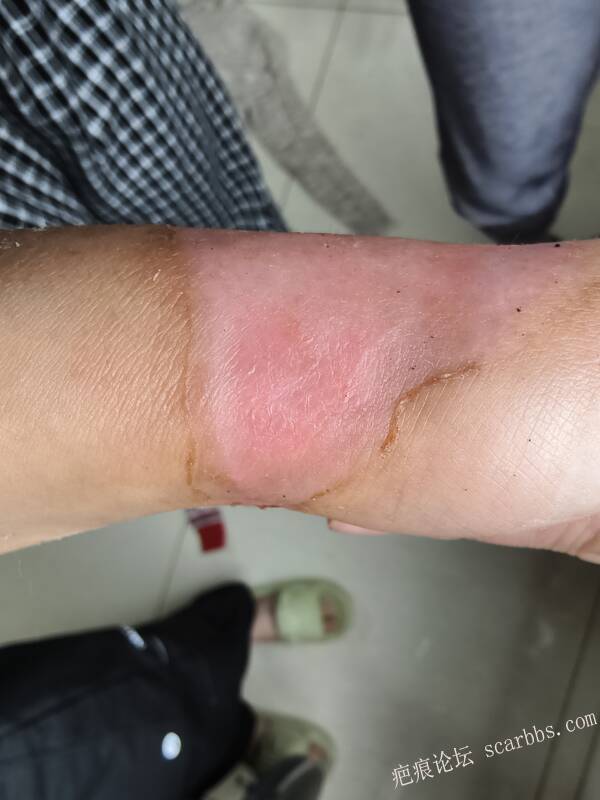 李高令，2026 年除夕夜接治烟台受伤孩子。 