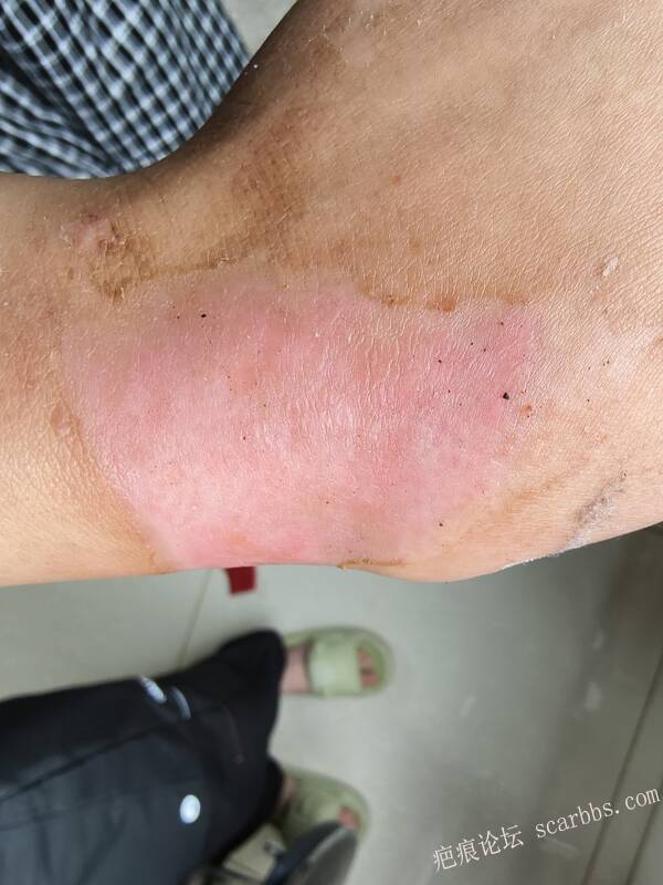 李高令，2026 年除夕夜接治烟台受伤孩子。 