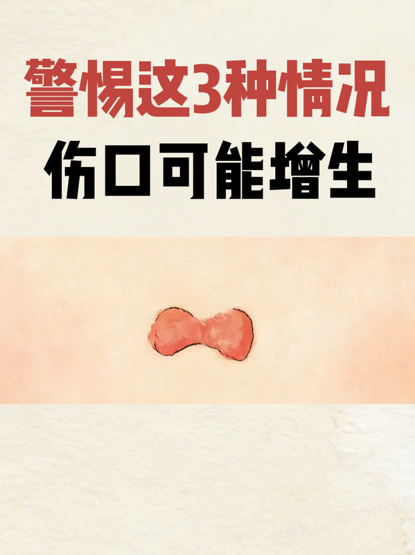 警惕这3种情况 伤口可能增生