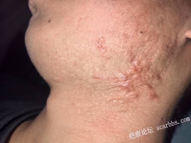 哪种效果会更好