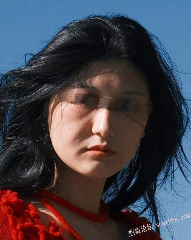 有没有成人表情凹 治愈的案例呀？