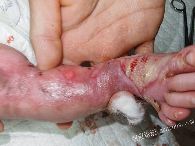 李高令老了，确真的很苦恼！走路腿还疼…今天却必须要岀一次远门。（北京新生儿皮缺… 