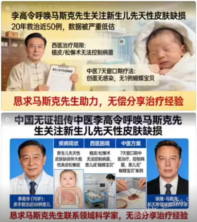 李高令老了，确真的很苦恼！走路腿还疼…今天却必须要岀一次远门。（北京新生儿皮缺… 