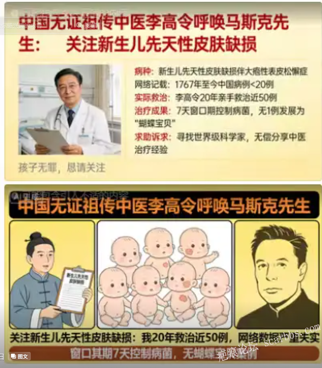 李高令老了，确真的很苦恼！走路腿还疼…今天却必须要岀一次远门。（北京新生儿皮缺… 