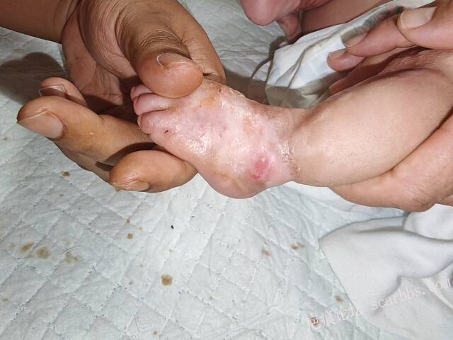 李高令老了，确真的很苦恼！走路腿还疼…今天却必须要岀一次远门。（北京新生儿皮缺… 