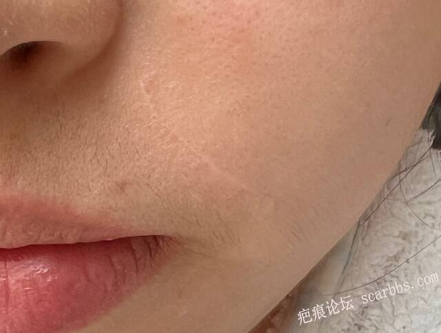 切缝四年 