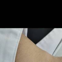 抓伤疤已经9个月了